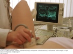 Ultraschalluntersuchung zur Schwangerschaft.
